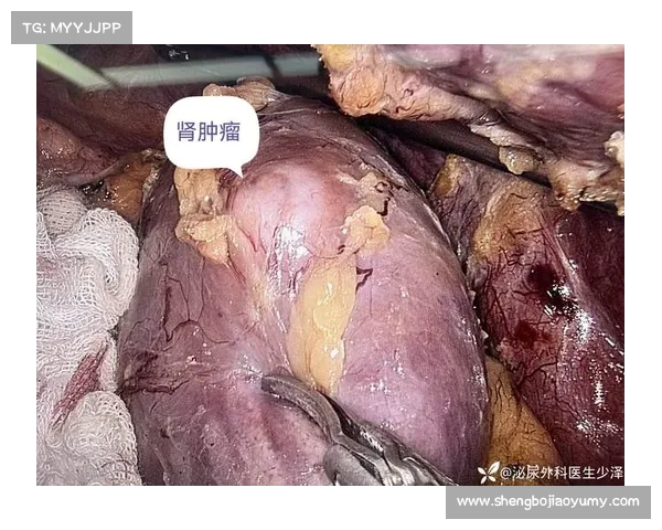 从肾癌病房到商业帝国:韦德如何用三重身份重塑人生 从肾癌病房到商业帝国:韦德如何用三重身份重塑人生